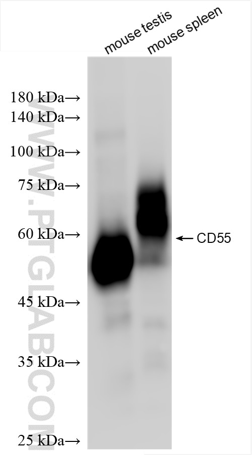 Western Blot (WB) analysis of various lysates using CD55 Recombinant antibody (84519-6-RR)