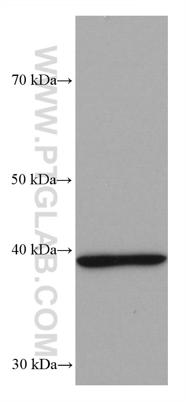 Western Blot (WB) analysis of mouse brain tissue using CD57 Monoclonal antibody (66711-1-Ig)