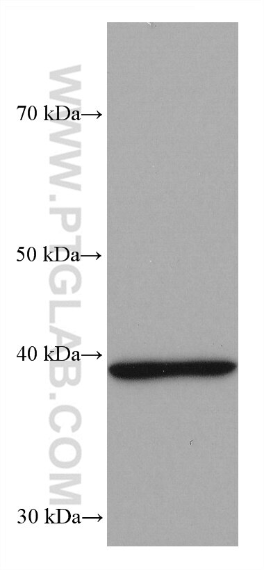 WB analysis of mouse brain using 66711-1-Ig