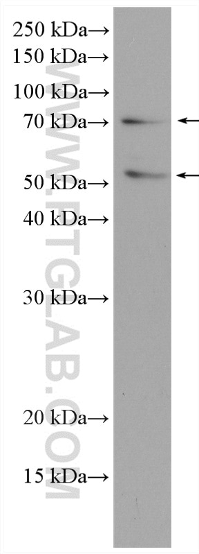 Western Blot (WB) analysis of TF-1 cells using CD58 Polyclonal antibody (10878-1-AP)