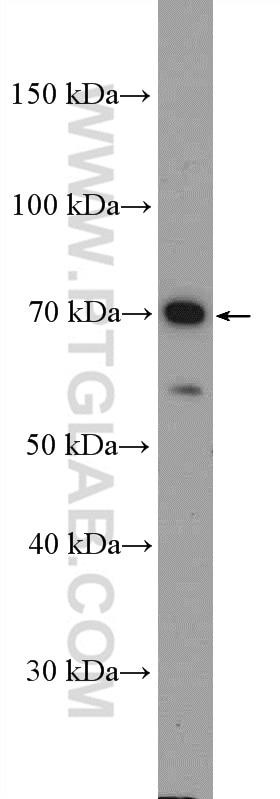 Western Blot (WB) analysis of Jurkat cells using CD58 Polyclonal antibody (10878-1-AP)