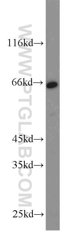 Western Blot (WB) analysis of HeLa cells using CD58 Polyclonal antibody (10878-1-AP)