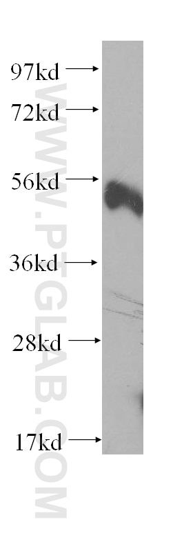 Western Blot (WB) analysis of human lymph tissue using CD58 Polyclonal antibody (10878-1-AP)