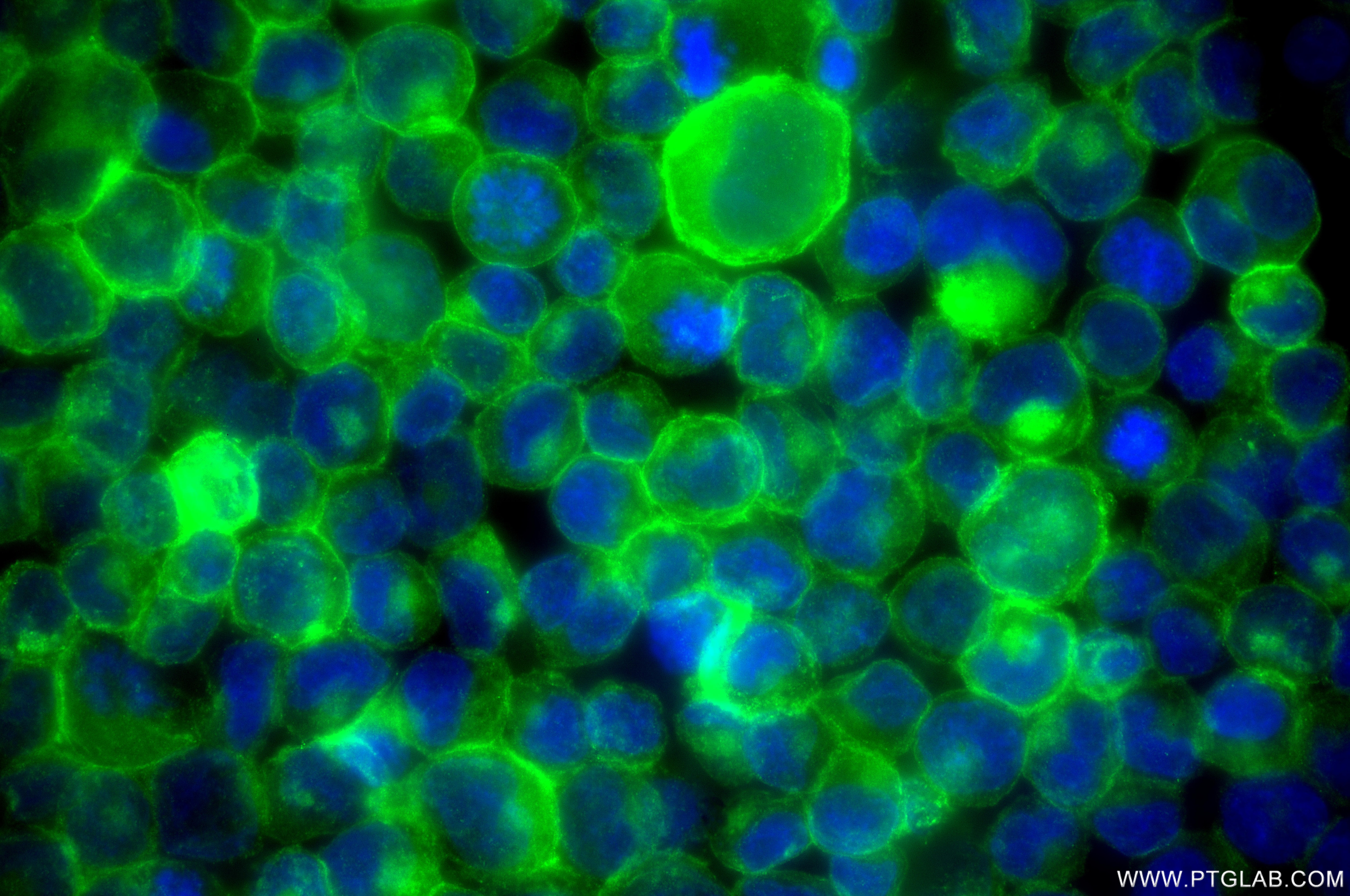 Immunofluorescence (IF) / fluorescent staining of K-562 cells using CD58 Recombinant monoclonal antibody (85950-1-RR)