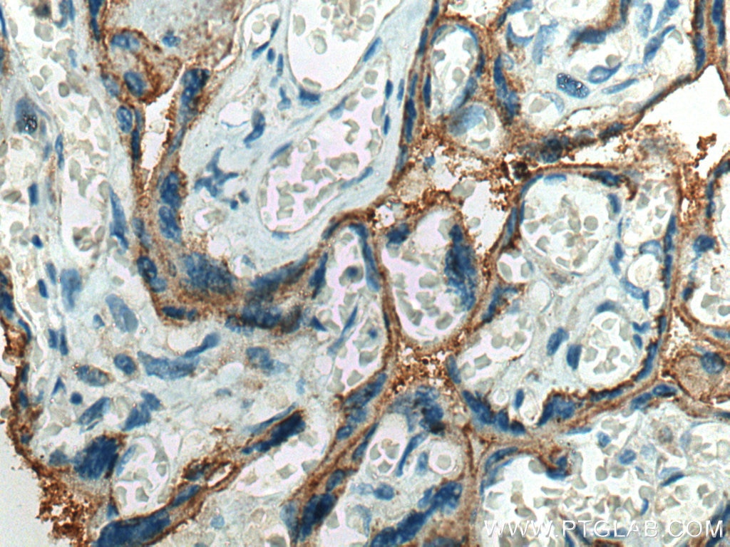 Immunohistochemistry (IHC) staining of human placenta tissue using CD59 Polyclonal antibody (10742-1-AP)