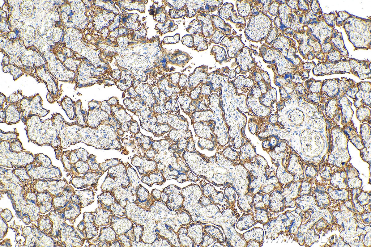 Immunohistochemistry (IHC) staining of human placenta tissue using CD59 Polyclonal antibody (10742-1-AP)