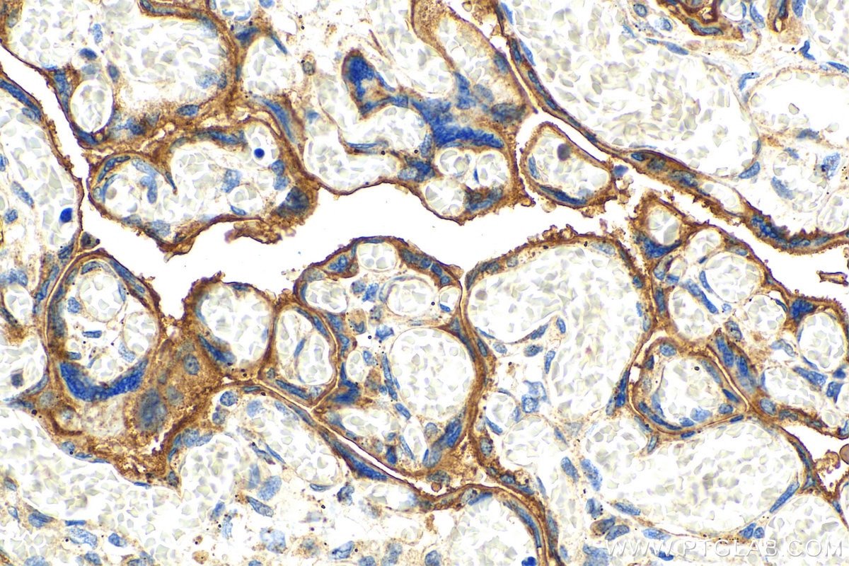 Immunohistochemistry (IHC) staining of human placenta tissue using CD59 Polyclonal antibody (10742-1-AP)