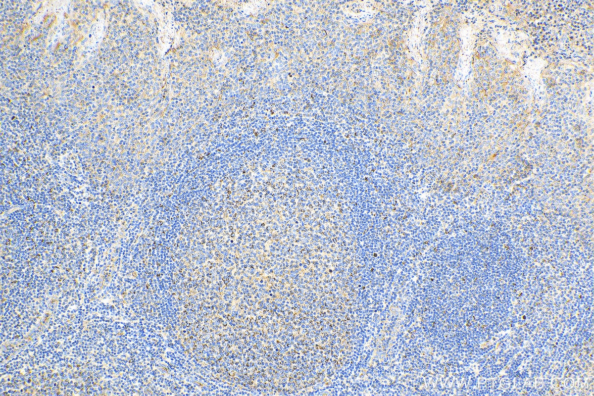 Immunohistochemistry (IHC) staining of human tonsillitis tissue using CD59 Polyclonal antibody (10742-1-AP)
