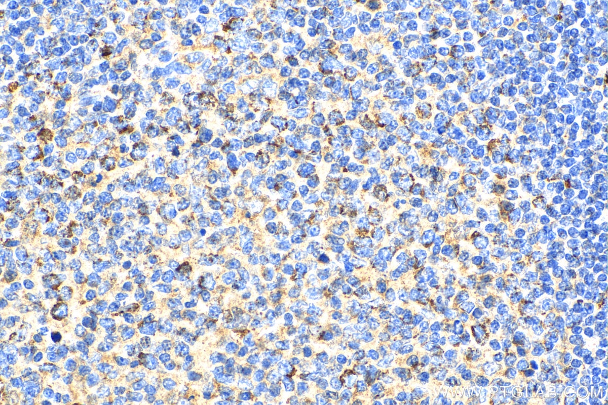 Immunohistochemistry (IHC) staining of human tonsillitis tissue using CD59 Polyclonal antibody (10742-1-AP)