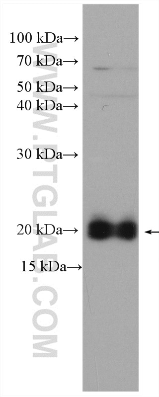 Western Blot (WB) analysis of HUVEC cells using CD59 Polyclonal antibody (10742-1-AP)