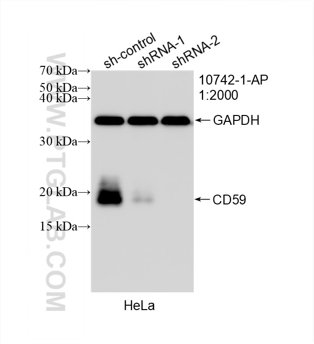 Western Blot (WB) analysis of HeLa cells using CD59 Polyclonal antibody (10742-1-AP)