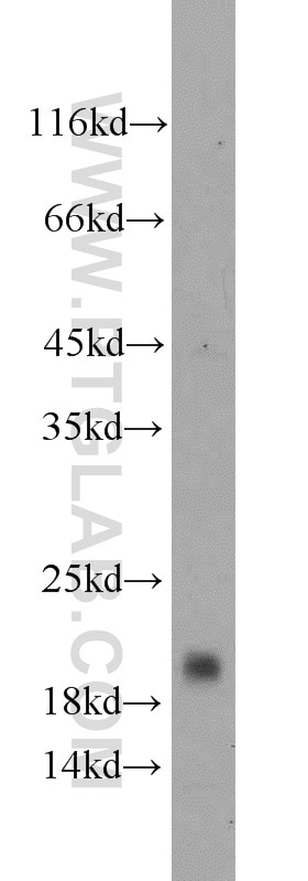 Western Blot (WB) analysis of human brain tissue using CD59 Polyclonal antibody (10742-1-AP)