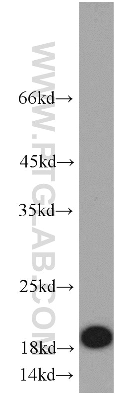 Western Blot (WB) analysis of BxPC-3 cells using CD59 Polyclonal antibody (10742-1-AP)