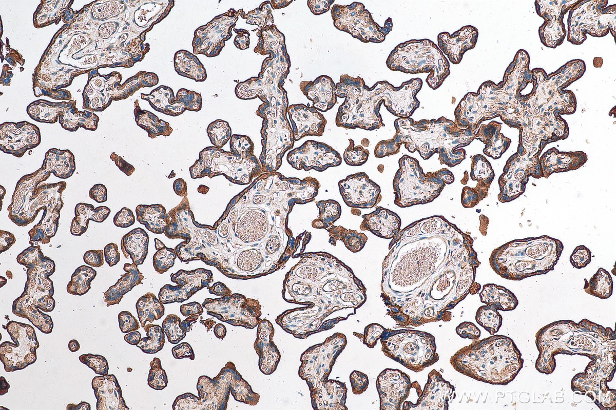 Immunohistochemistry (IHC) staining of human placenta tissue using CD59 Polyclonal antibody (30223-1-AP)