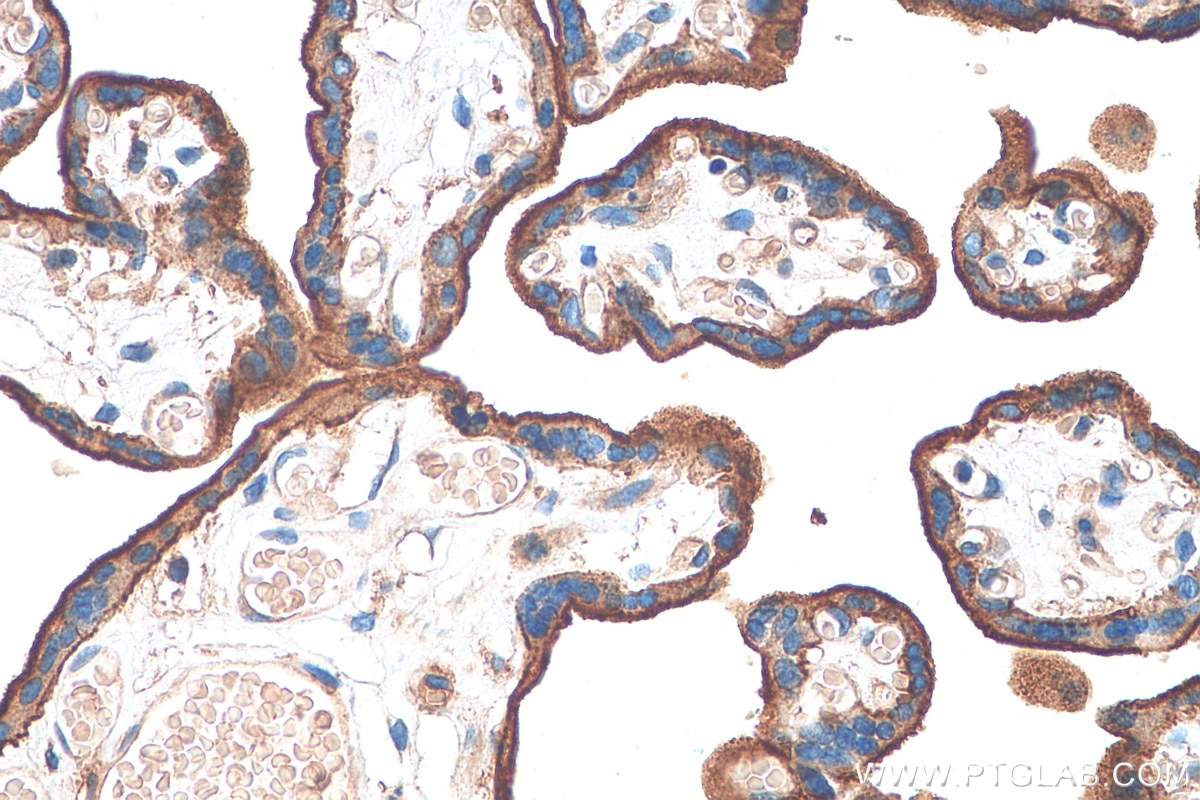 Immunohistochemistry (IHC) staining of human placenta tissue using CD59 Polyclonal antibody (30223-1-AP)