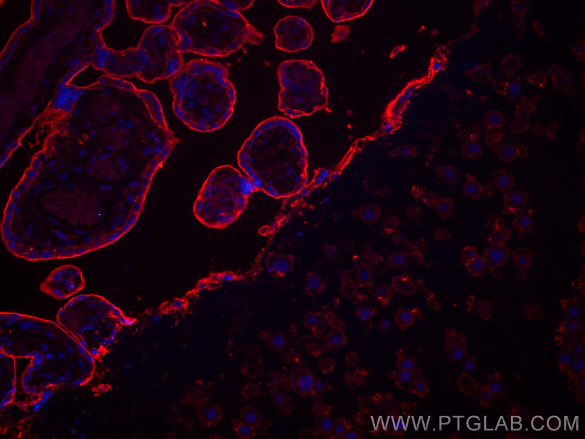 Immunofluorescence (IF) / fluorescent staining of human placenta tissue using CD59 Monoclonal antibody (68222-1-Ig)