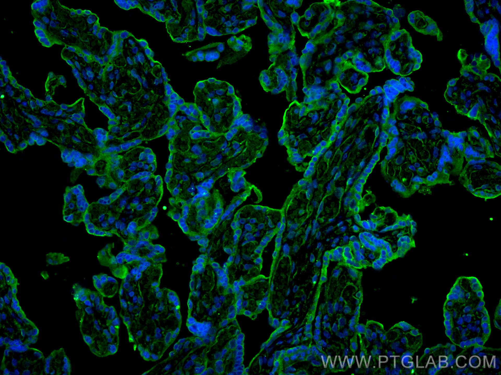 Immunofluorescence (IF) / fluorescent staining of human placenta tissue using CD59 Monoclonal antibody (68222-1-Ig)
