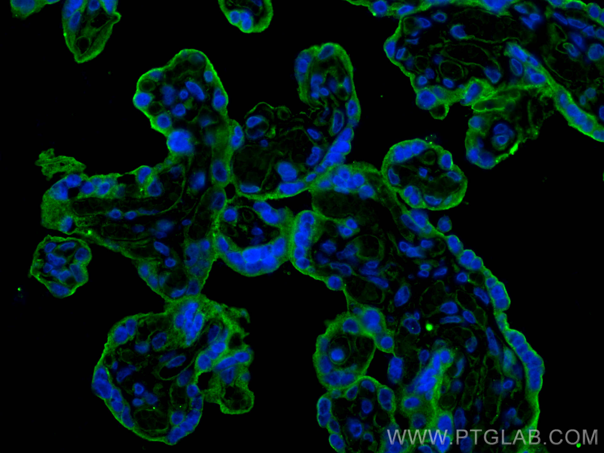 Immunofluorescence (IF) / fluorescent staining of human placenta tissue using CD59 Monoclonal antibody (68222-1-Ig)