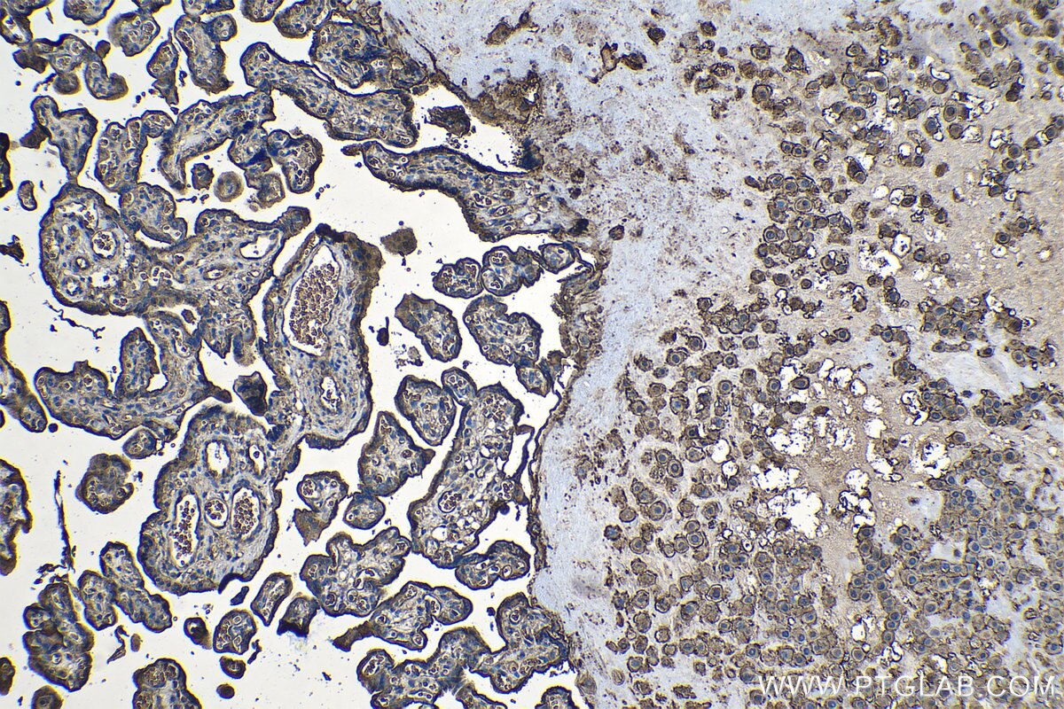 Immunohistochemistry (IHC) staining of human placenta tissue using CD59 Monoclonal antibody (68222-1-Ig)