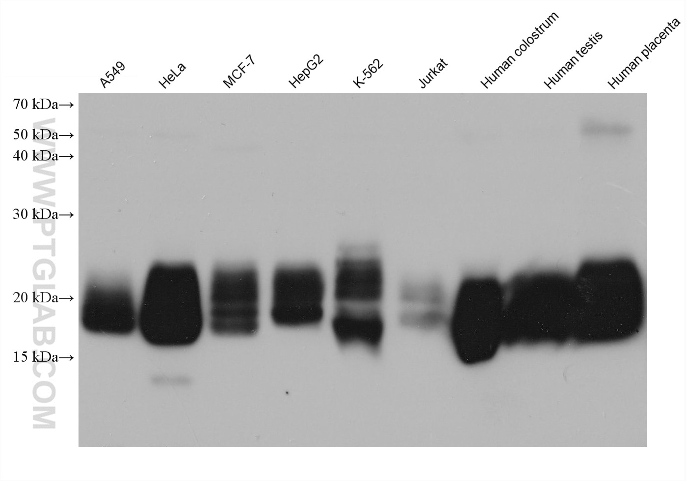 Western Blot (WB) analysis of various lysates using CD59 Monoclonal antibody (68222-1-Ig)