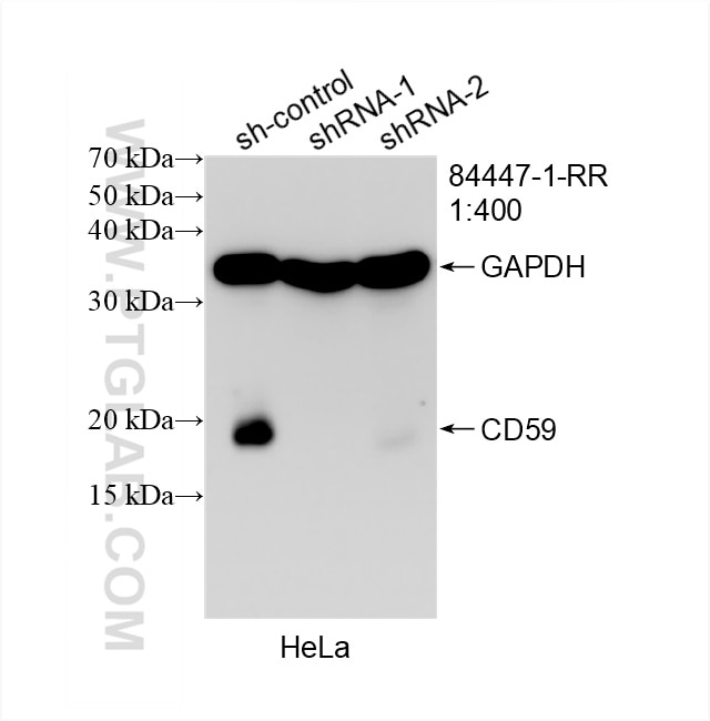 Western Blot (WB) analysis of HeLa cells using CD59 Recombinant antibody (84447-1-RR)