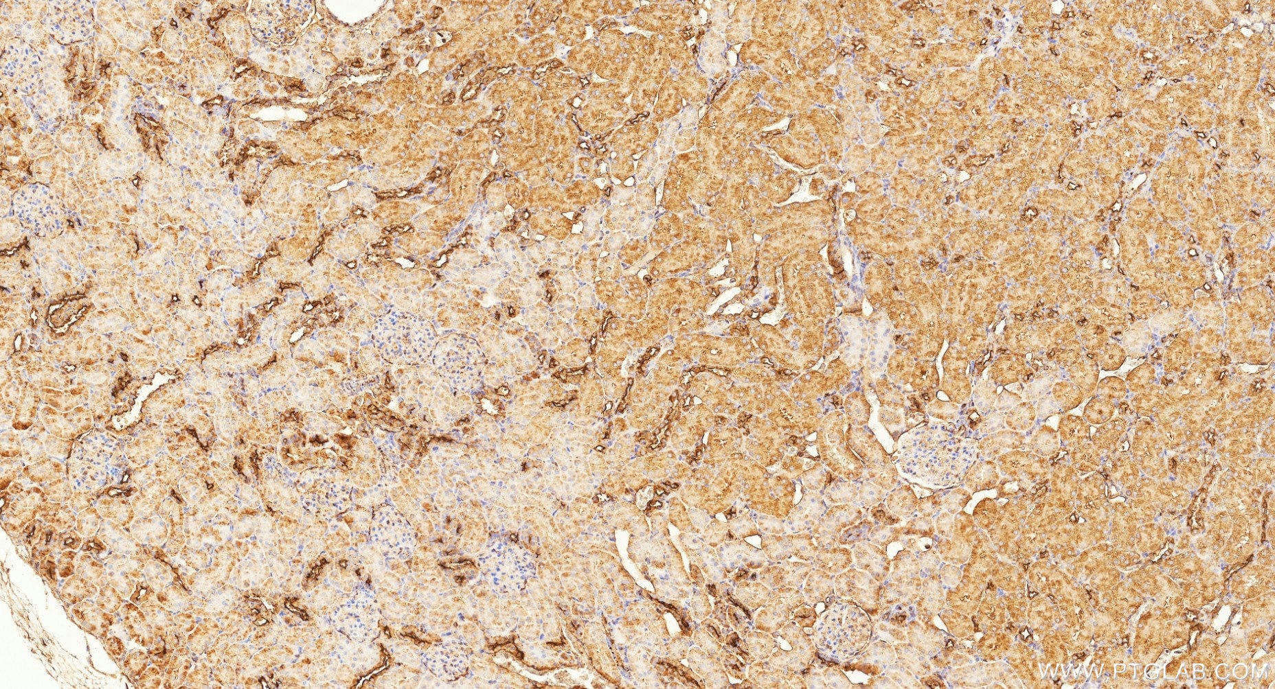 IHC staining of rat kidney using 87072-1-RR Immunohistochemistry (IHC) staining of rat kidney tissue using CD59 Recombinant monoclonal antibody (87072-1-RR)
