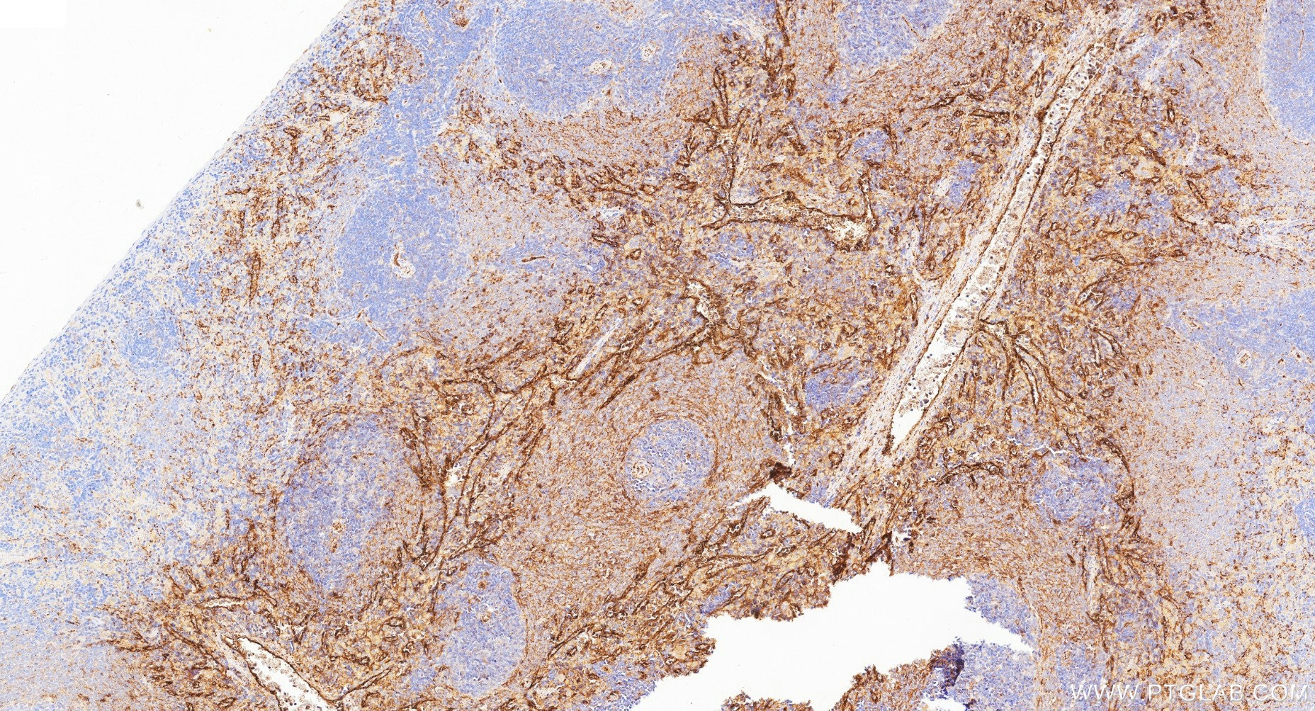 IHC staining of rat spleen using 87072-1-RR Immunohistochemistry (IHC) staining of rat spleen tissue using CD59 Recombinant monoclonal antibody (87072-1-RR)