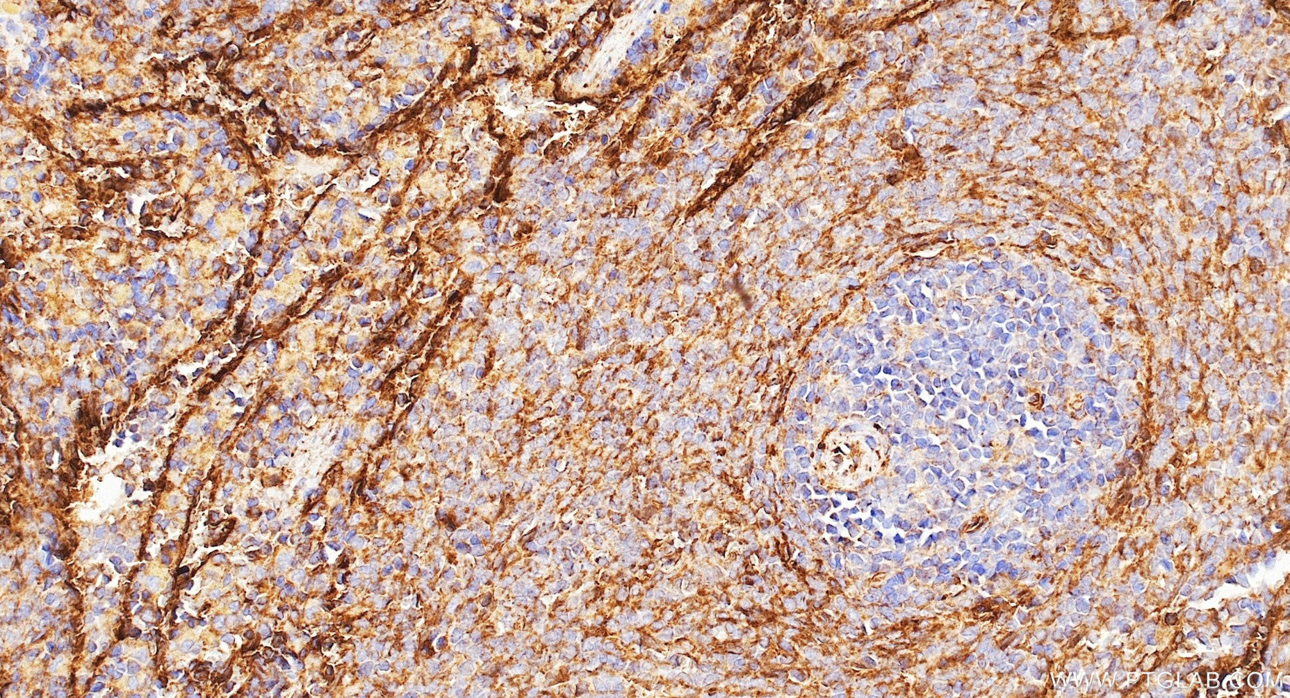 IHC staining of rat spleen using 87072-1-RR Immunohistochemistry (IHC) staining of rat spleen tissue using CD59 Recombinant monoclonal antibody (87072-1-RR)
