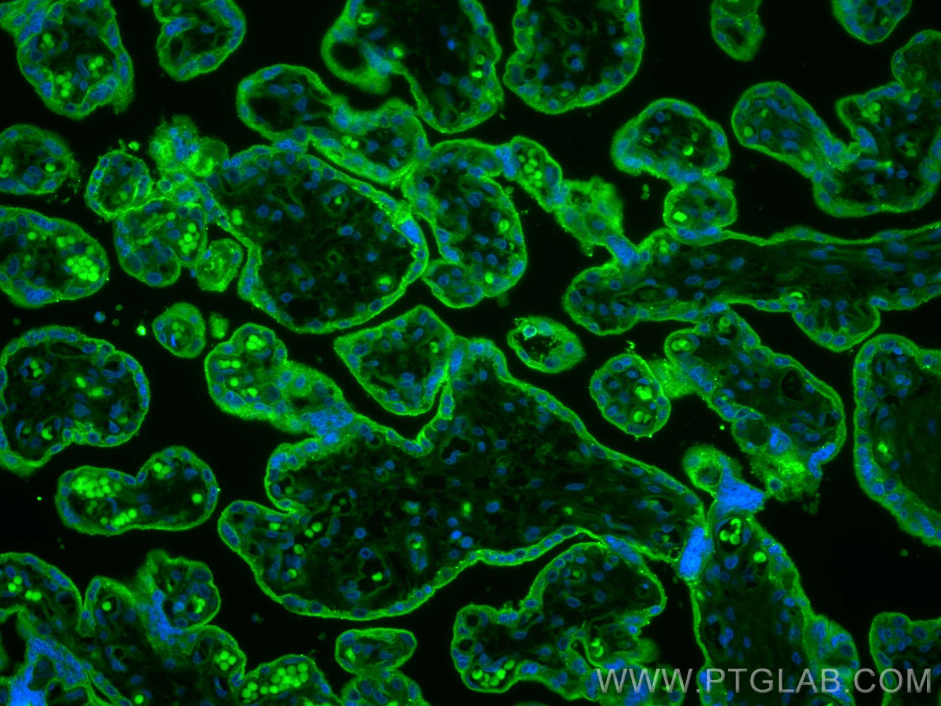 Immunofluorescence (IF) / fluorescent staining of human placenta tissue using CoraLite® Plus 488-conjugated CD59 Monoclonal anti (CL488-68222)