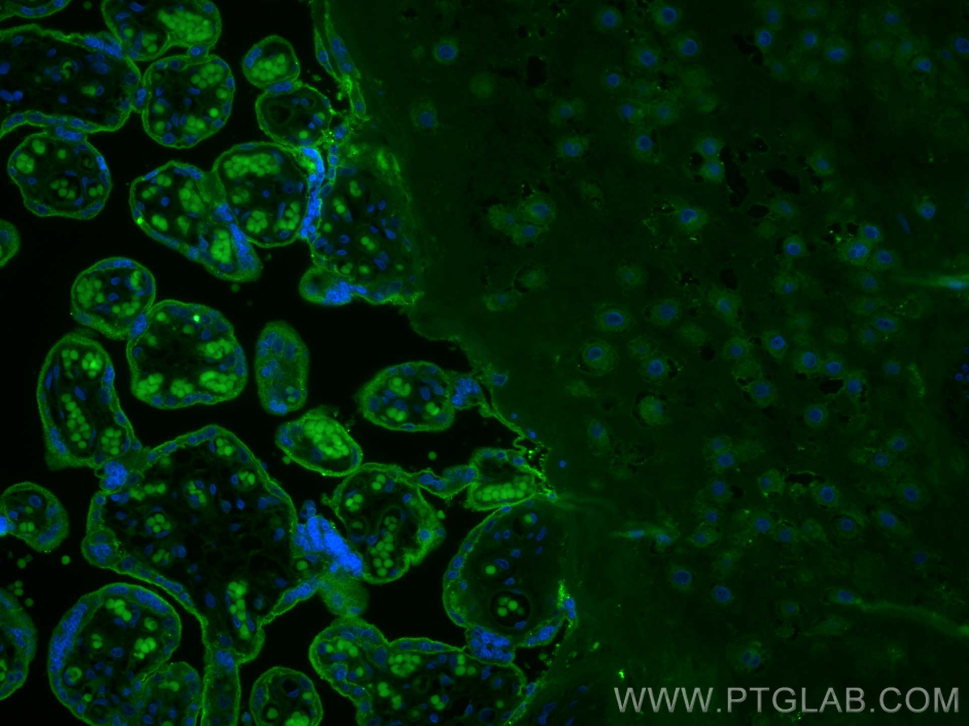 Immunofluorescence (IF) / fluorescent staining of human placenta tissue using CoraLite® Plus 488-conjugated CD59 Monoclonal anti (CL488-68222)