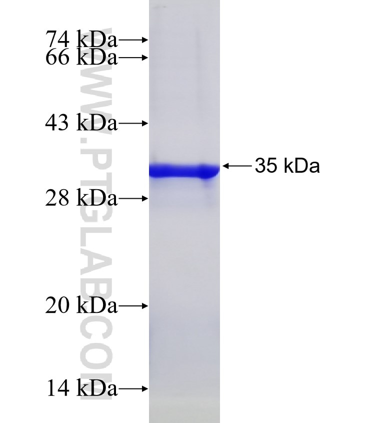 CD59 fusion protein Ag32557 SDS-PAGE