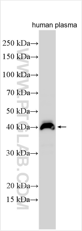 WB analysis of human plasma using 17224-1-AP