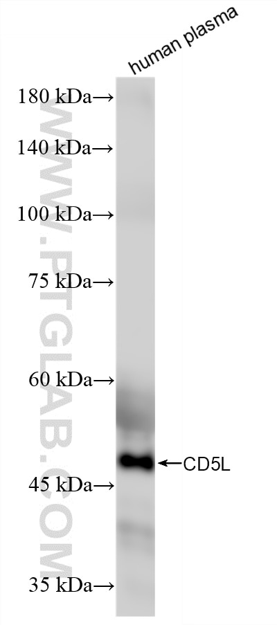 Western Blot (WB) analysis of human plasma using CD5L Recombinant monoclonal antibody (86638-1-RR)