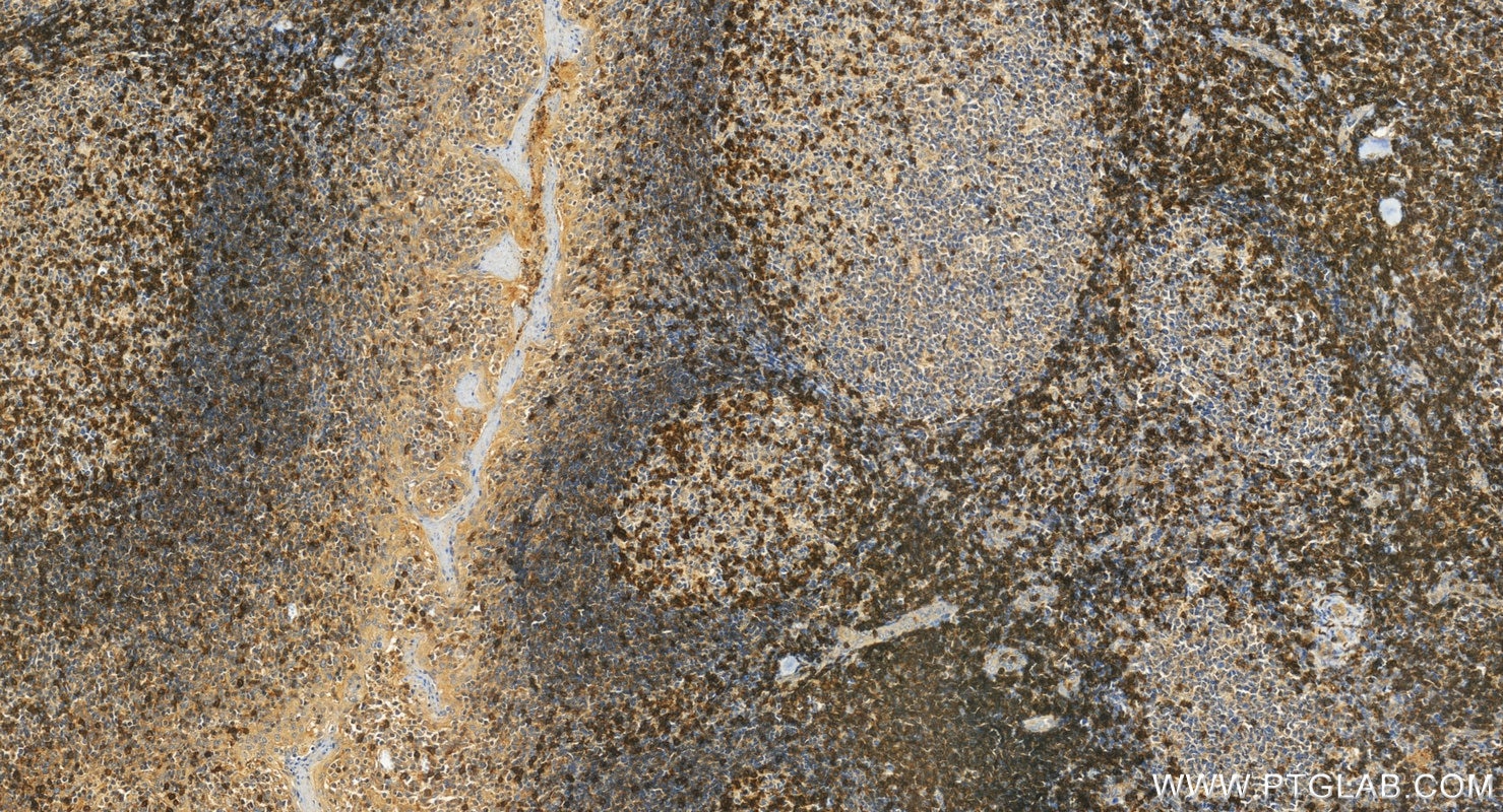 Immunohistochemistry (IHC) staining of human tonsillitis tissue using CD6 Polyclonal antibody (16763-1-AP)