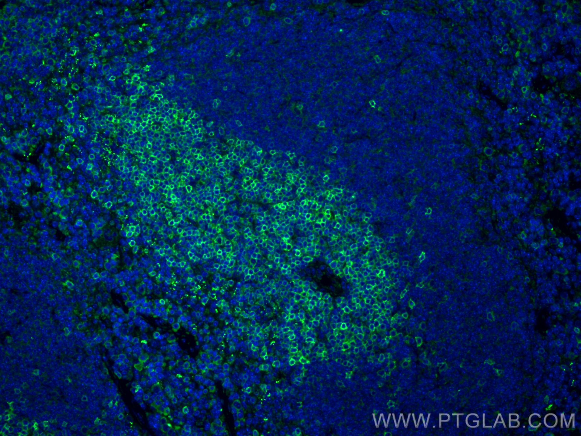 IF Staining of mouse spleen using 31998-1-AP Immunofluorescence (IF) / fluorescent staining of mouse spleen tissue using CD6 Polyclonal antibody (31998-1-AP)