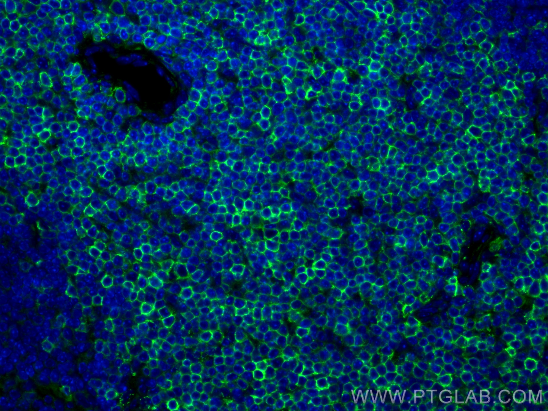 IF Staining of mouse spleen using 31998-1-AP Immunofluorescence (IF) / fluorescent staining of mouse spleen tissue using CD6 Polyclonal antibody (31998-1-AP)