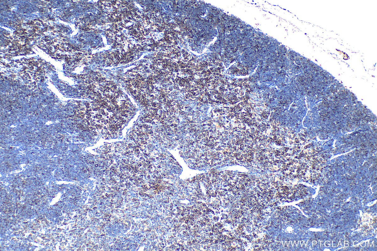 IHC staining of mouse thymus using 31998-1-AP Immunohistochemistry (IHC) staining of mouse thymus tissue using CD6 Polyclonal antibody (31998-1-AP)