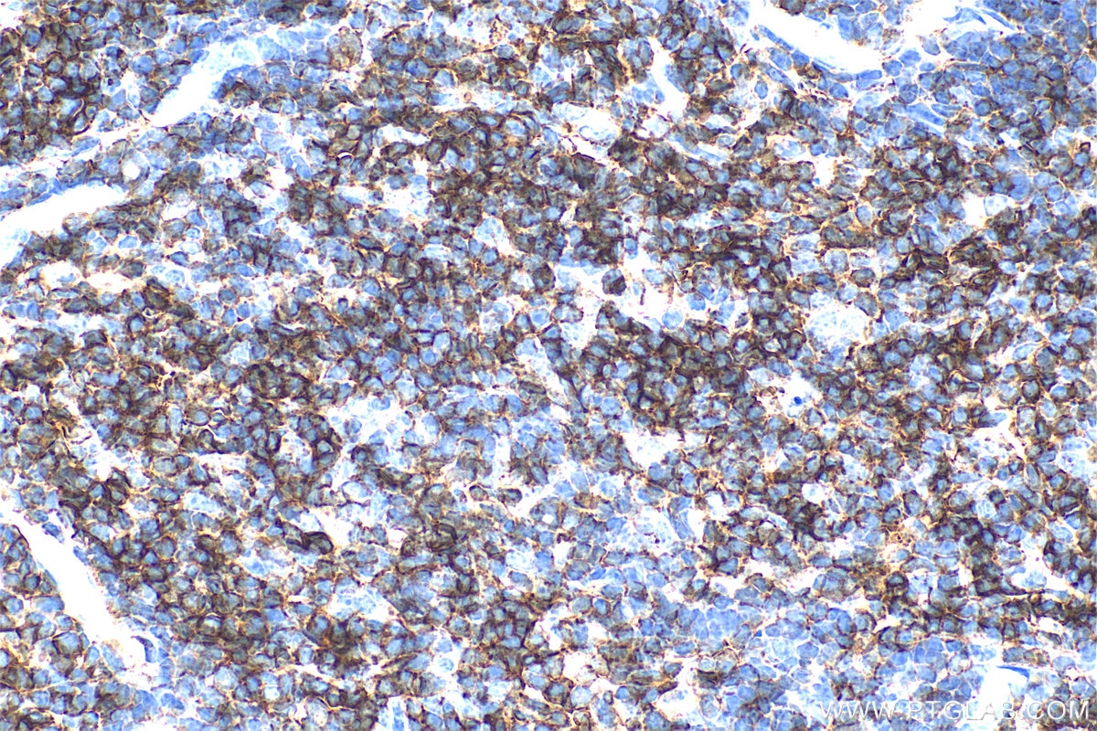 IHC staining of mouse thymus using 31998-1-AP Immunohistochemistry (IHC) staining of mouse thymus tissue using CD6 Polyclonal antibody (31998-1-AP)