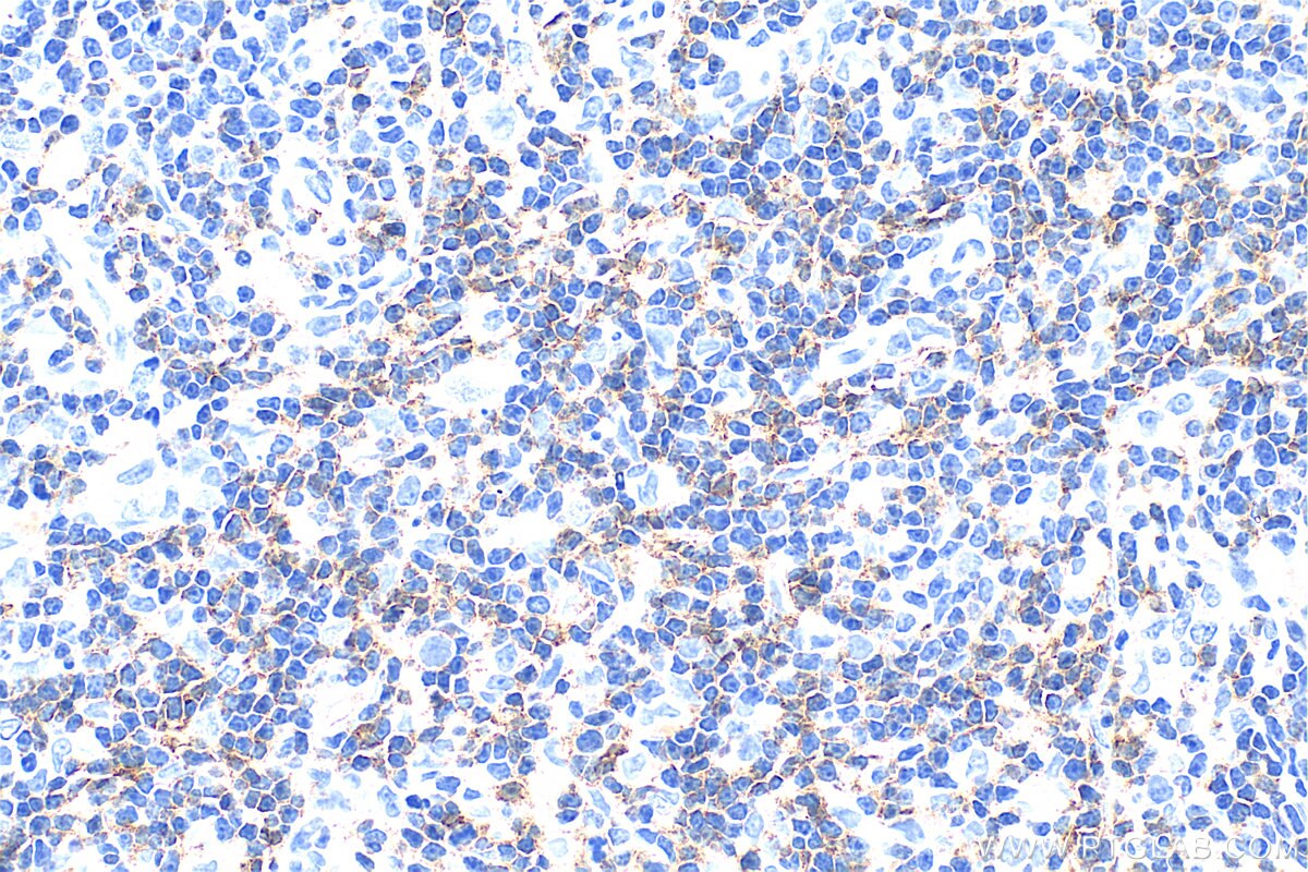 IHC staining of rat thymus using 31998-1-AP Immunohistochemistry (IHC) staining of rat thymus tissue using CD6 Polyclonal antibody (31998-1-AP)