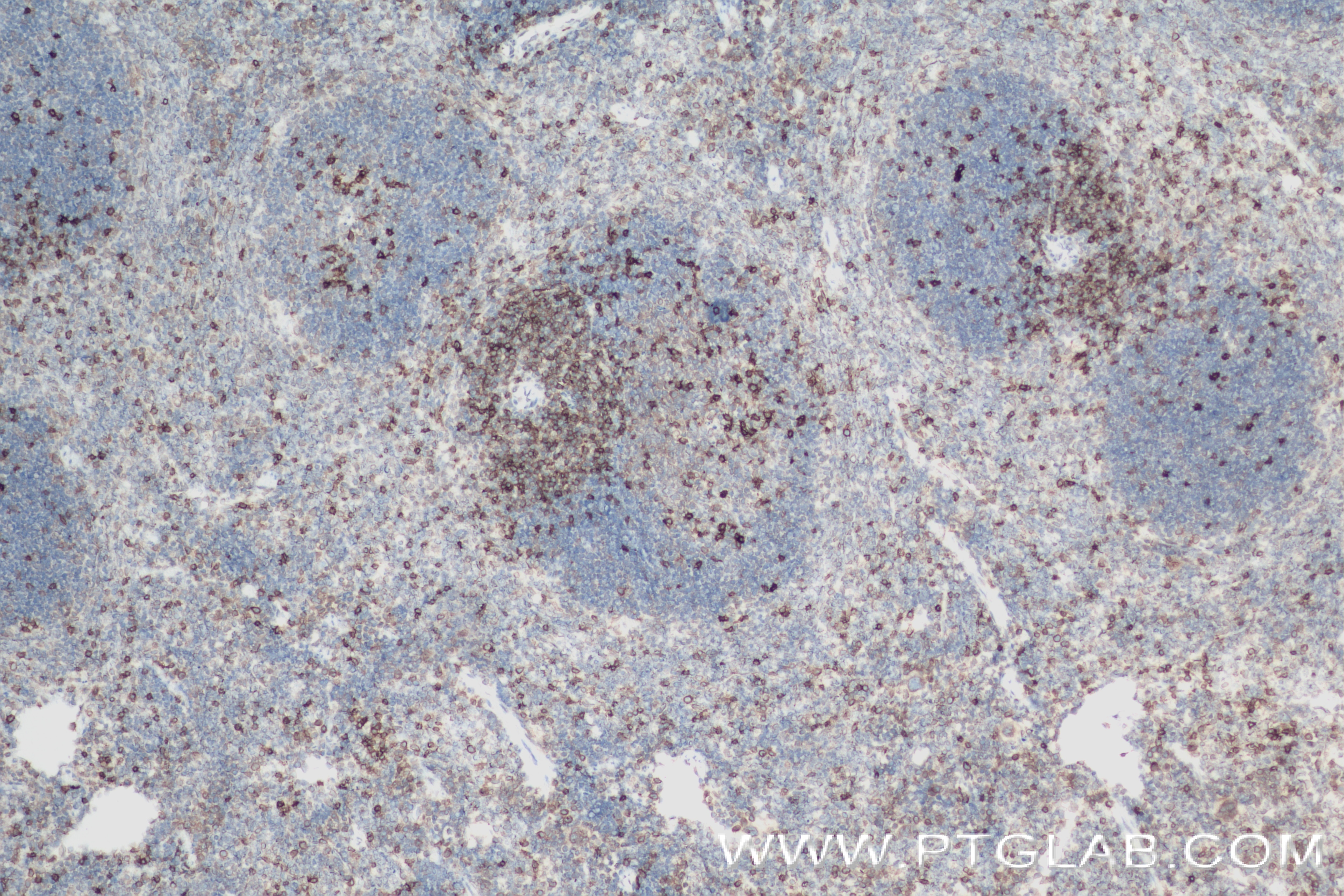 Immunohistochemistry (IHC) staining of mouse spleen tissue using CD6 Recombinant antibody (84166-5-RR)