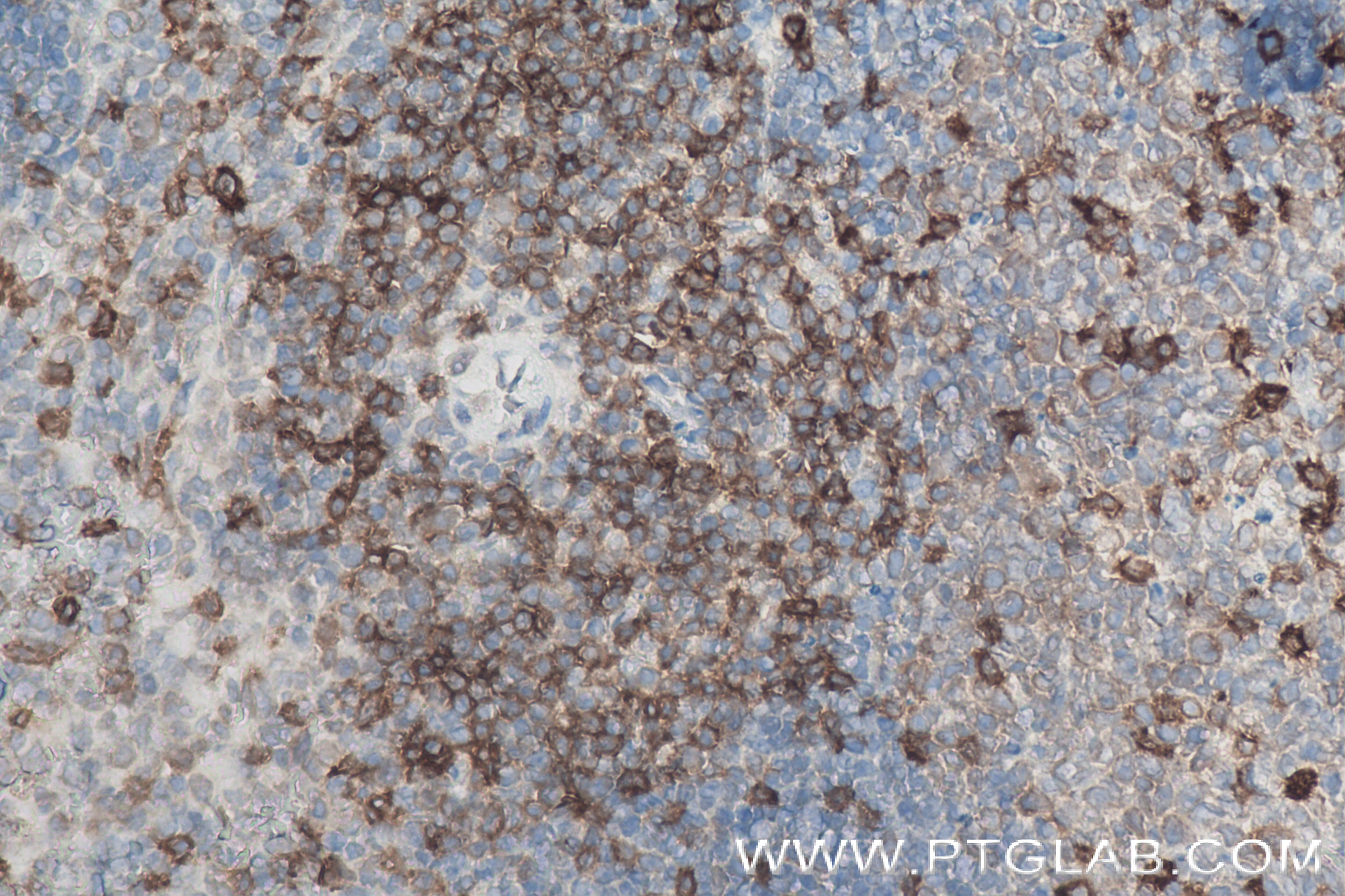 Immunohistochemistry (IHC) staining of mouse spleen tissue using CD6 Recombinant antibody (84166-5-RR)