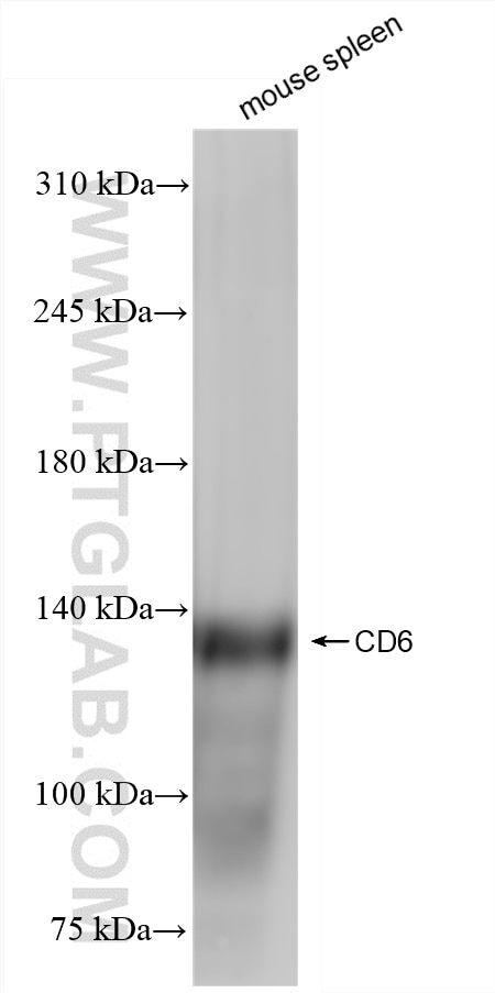 Western Blot (WB) analysis of mouse spleen tissue using CD6 Recombinant antibody (84166-5-RR)