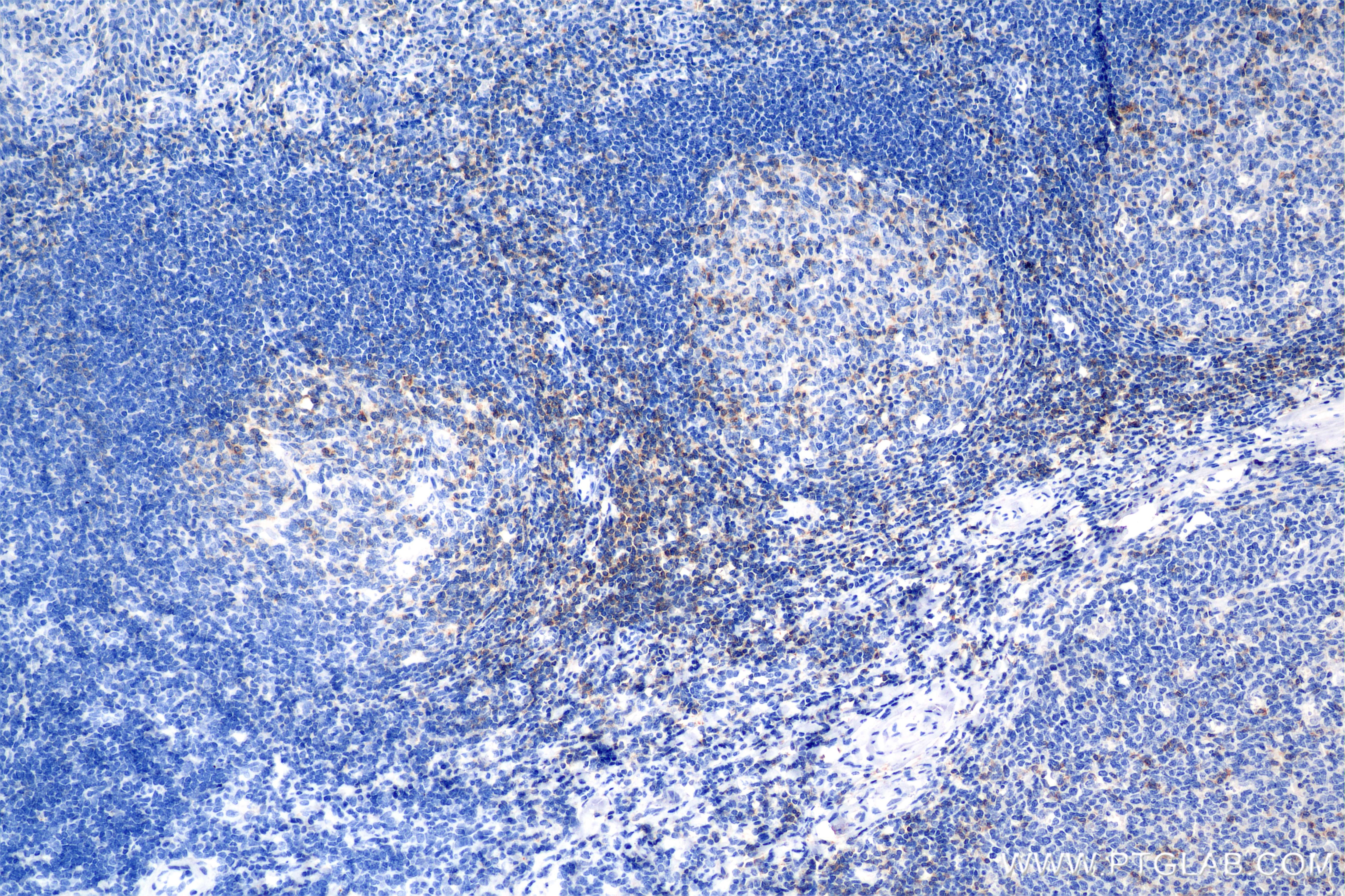 Immunohistochemistry (IHC) staining of human tonsil tissue using CD6 Recombinant antibody (84508-4-RR)