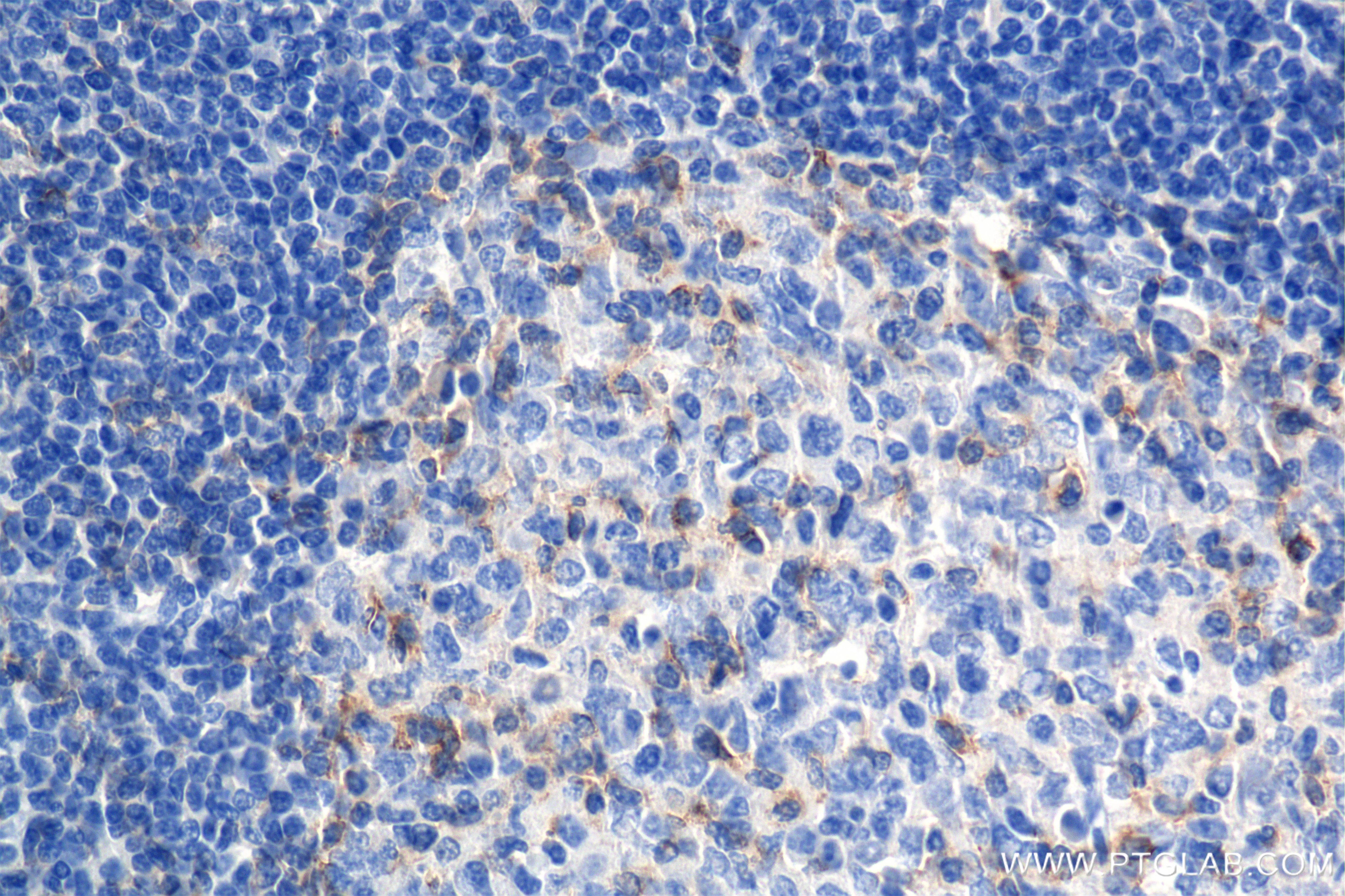 Immunohistochemistry (IHC) staining of human tonsil tissue using CD6 Recombinant antibody (84508-4-RR)