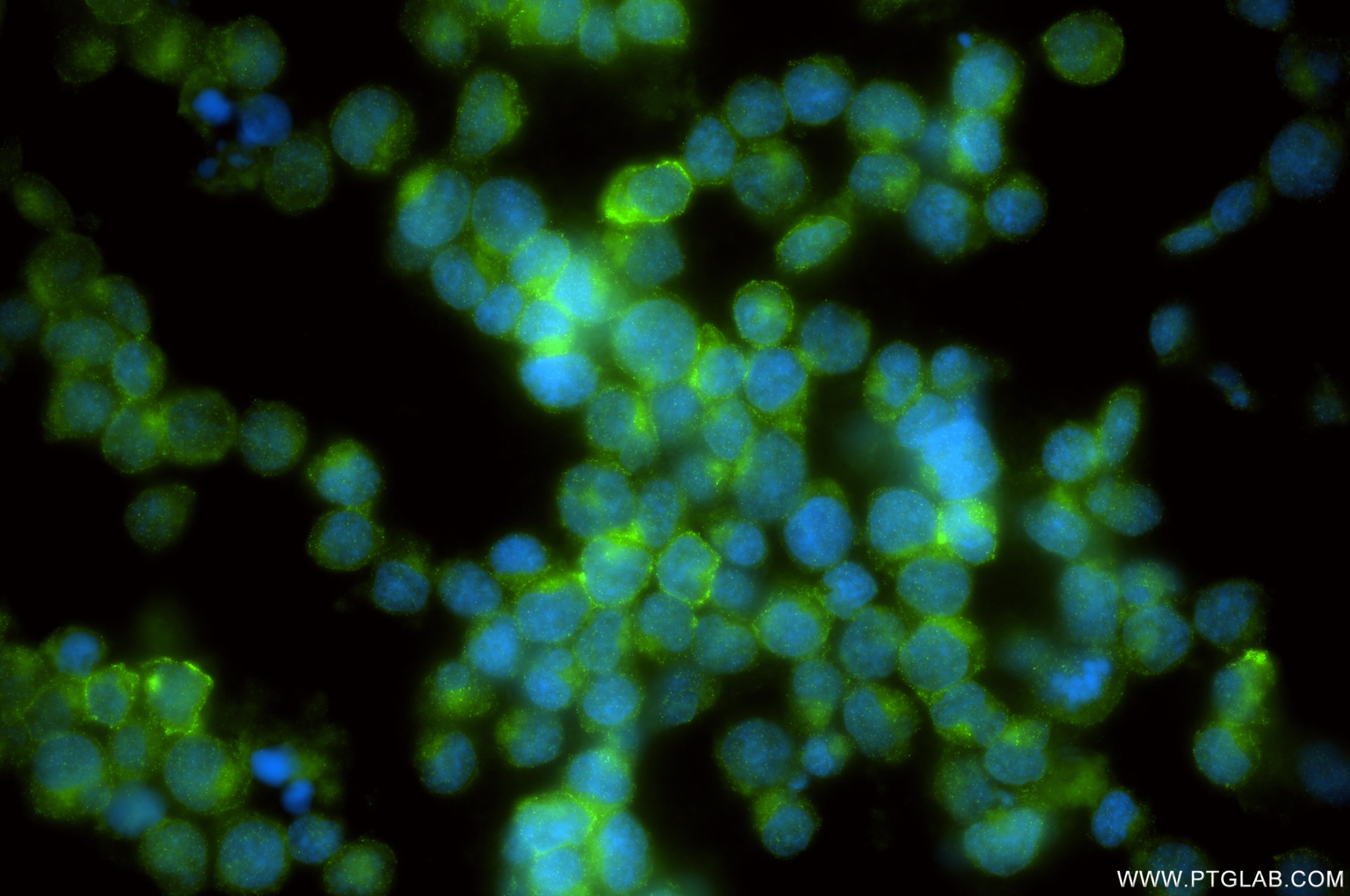 Immunofluorescent analysis of (4% PFA) fixed Jurkat cells using CD6 antibody (84508-5-RR, Clone: 241965D11 ) at dilution of 1:200 and CoraLite®488-Conjugated Goat Anti-Rabbit IgG(H+L) (SA00013-2). This data was developed using the same antibody clone with 84508-5-PBS in a different storage buffer formulation. Immunofluorescence (IF) / fluorescent staining of Jurkat cells using CD6 Recombinant monoclonal antibody (84508-5-RR)