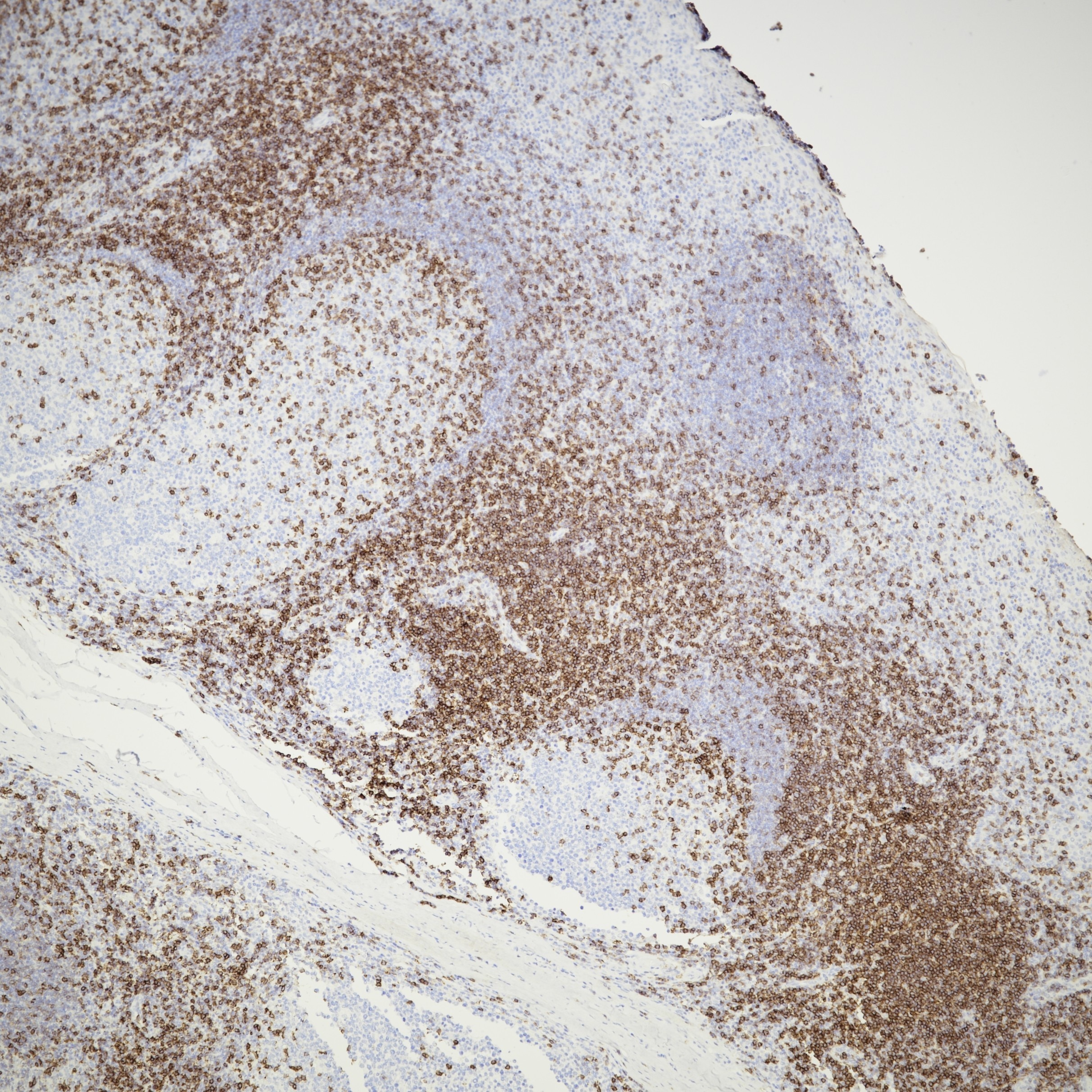 Immunohistochemistry (IHC) staining of human tonsil tissue using CD6 Recombinant monoclonal antibody (84508-5-RR)