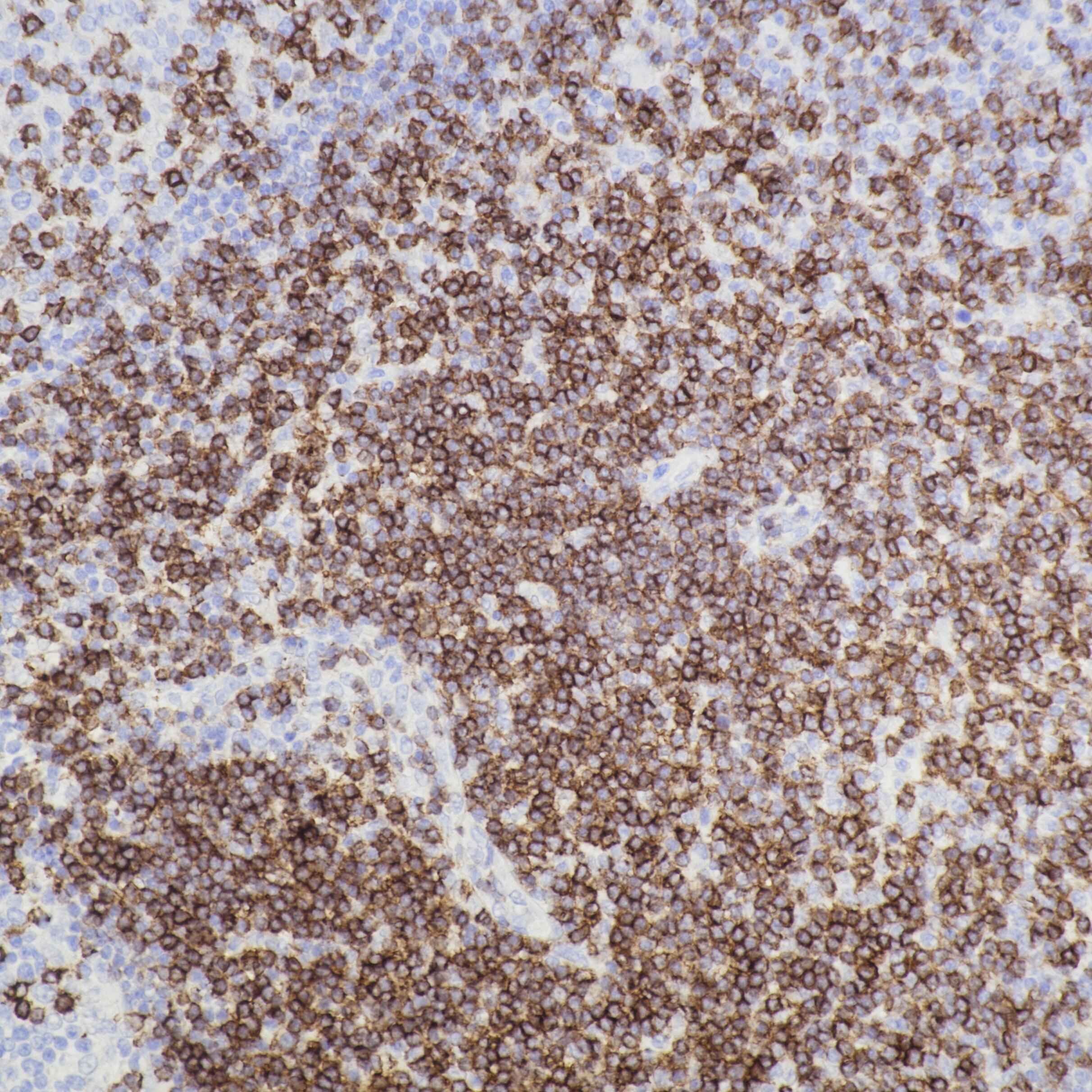 Immunohistochemistry (IHC) staining of human tonsil tissue using CD6 Recombinant monoclonal antibody (84508-5-RR)