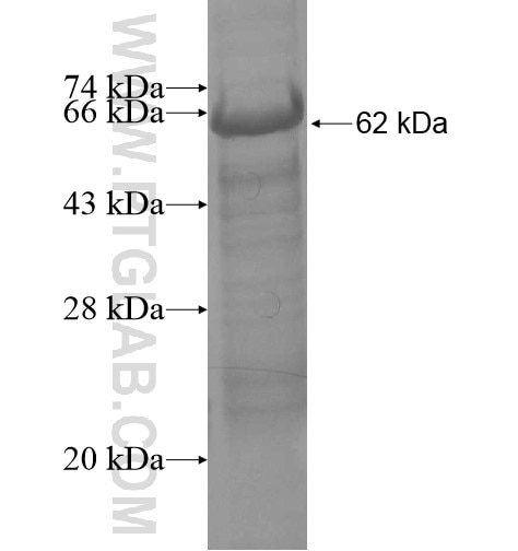 CD6 fusion protein Ag10336 SDS-PAGE
