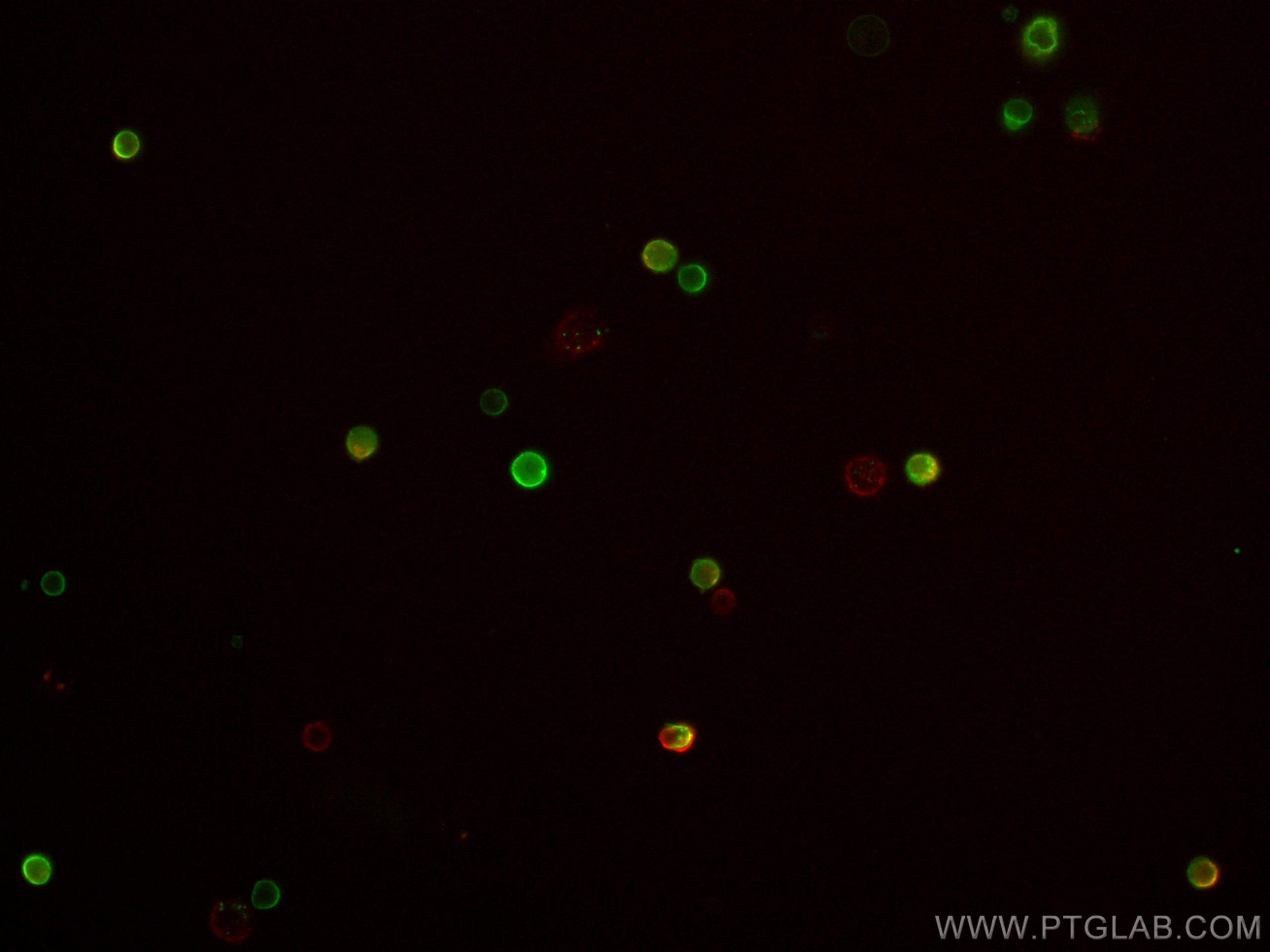 IF Staining of mouse splenocytes using CL647-65123