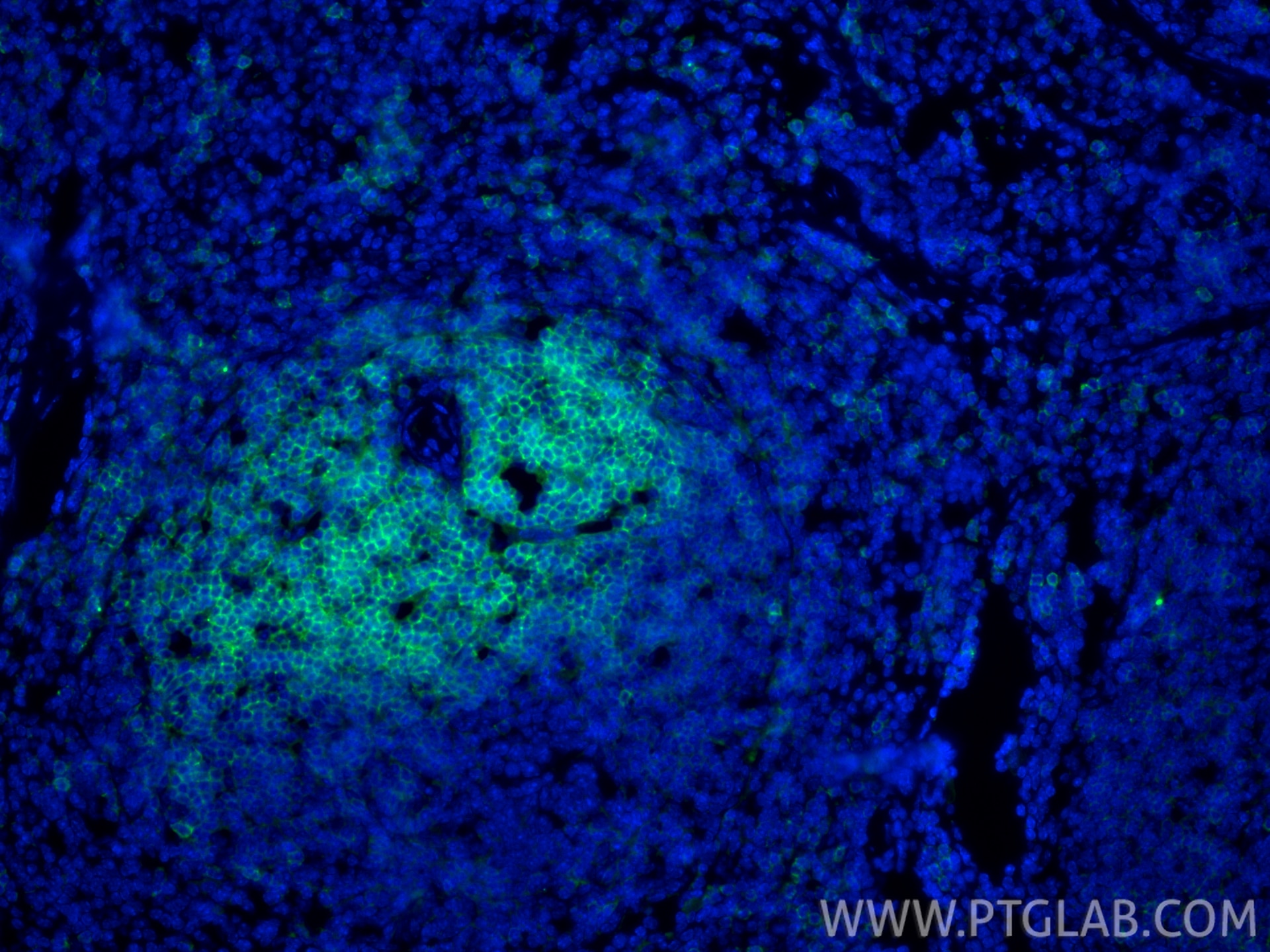 IF Staining of mouse spleen using 33173-1-AP Immunofluorescence (IF) / fluorescent staining of mouse spleen tissue using CD62L Polyclonal antibody (33173-1-AP)